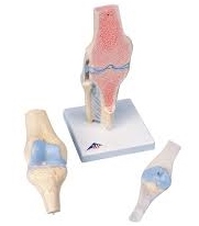 SECTIONAL KNEE JOINT MODEL , 3-PART